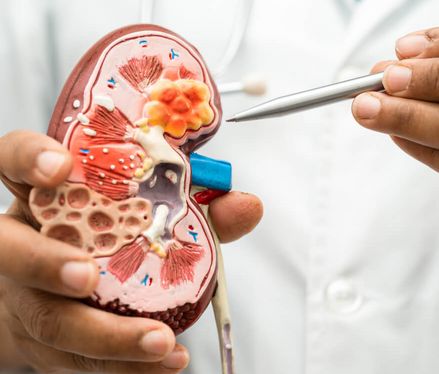 Häufige Fragen zur Nierentransplantation – Ein Ratgeber für Patienten