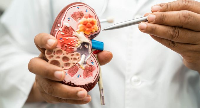 Nierentransplantation Arzt zeigt auf das Modell einer Niere