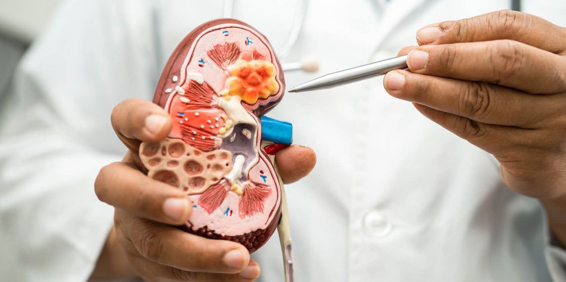 Nierentransplantation